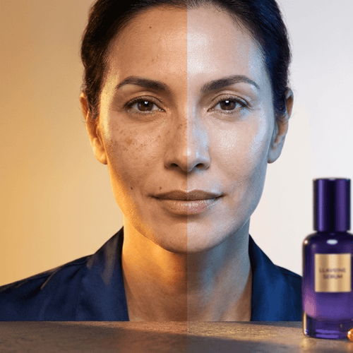 Taches pigmentaires après 40 ans : causes profondes et traitements efficaces